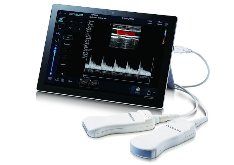 Портативні УЗД-апарати від Medigran